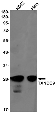 1 - TXNDC9 Rabbit mAb AP76216