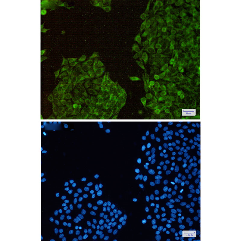 3 - TXNL1 Rabbit mAb AP76217