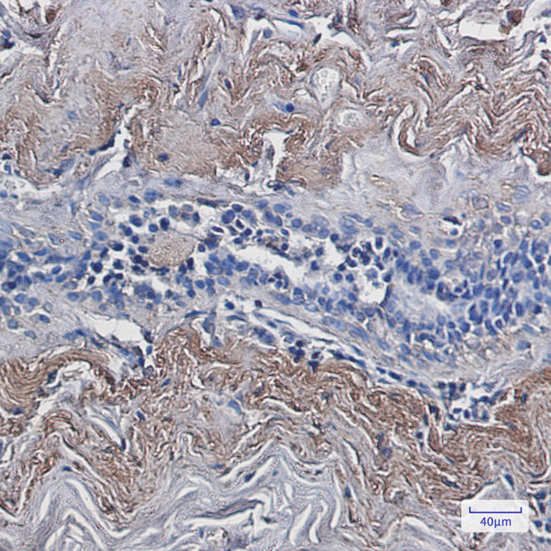 2 - TXNL1 Rabbit mAb AP76217