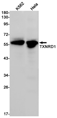 2 - TXNRD1 Rabbit mAb AP76218