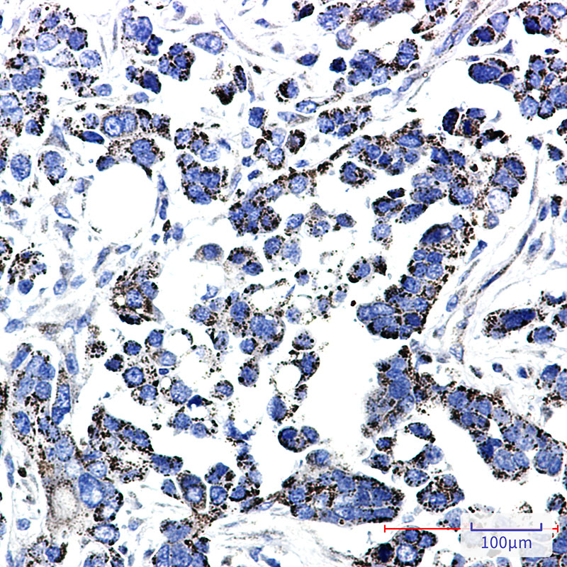 0 - TXNRD2 Rabbit mAb AP76219