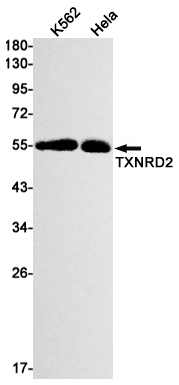 2 - TXNRD2 Rabbit mAb AP76219