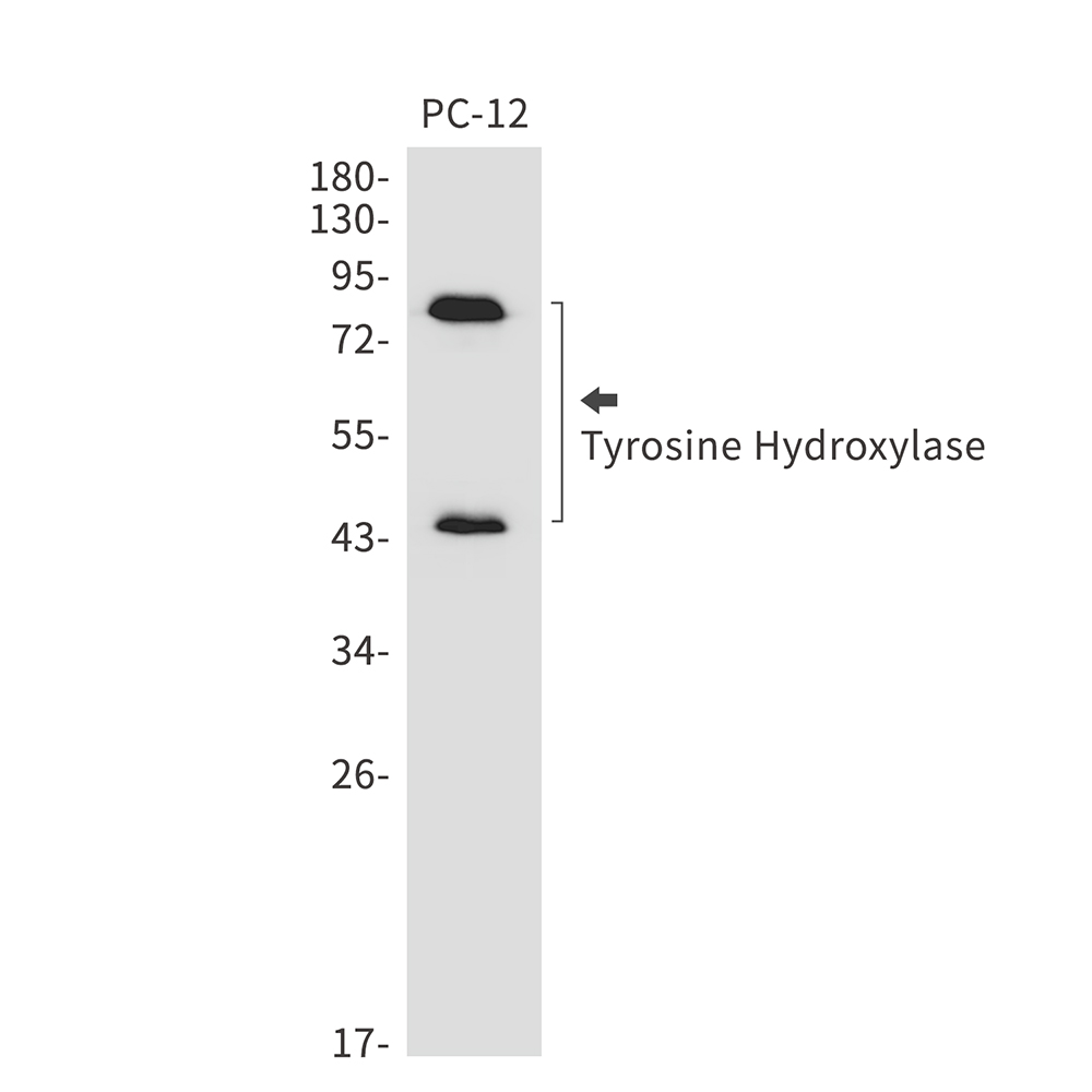 1 - Tyrosine Hydroxylase Rabbit mAb AP76220