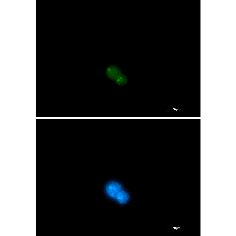 1 - UBA2 Rabbit mAb AP76222