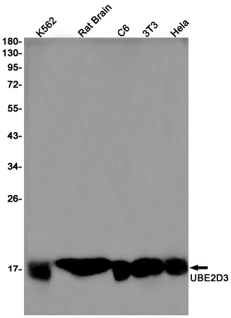 1 - Ubiquitin Conjugating Enzyme E2 D3 Rabbit mAb AP76223