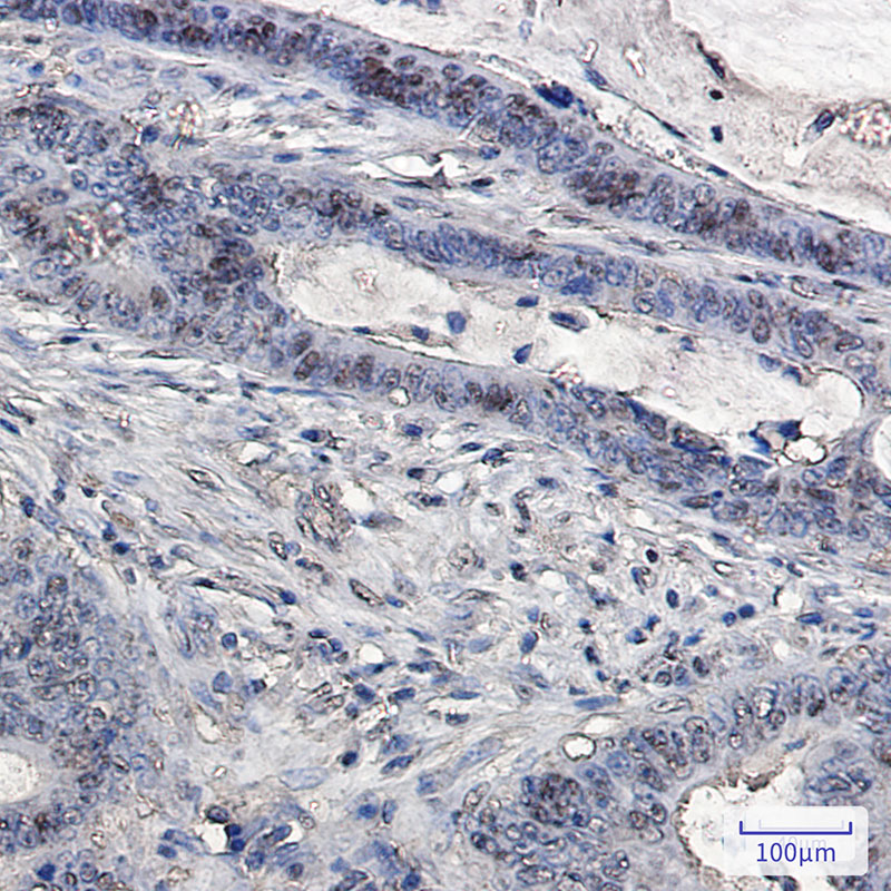 2 - Ubiquitin Rabbit mAb AP76225