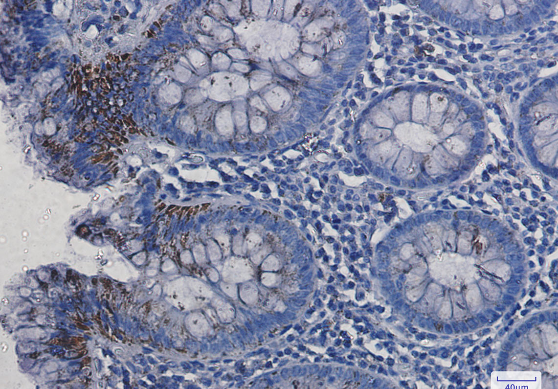 0 - VDAC1/Porin Rabbit mAb AP76240