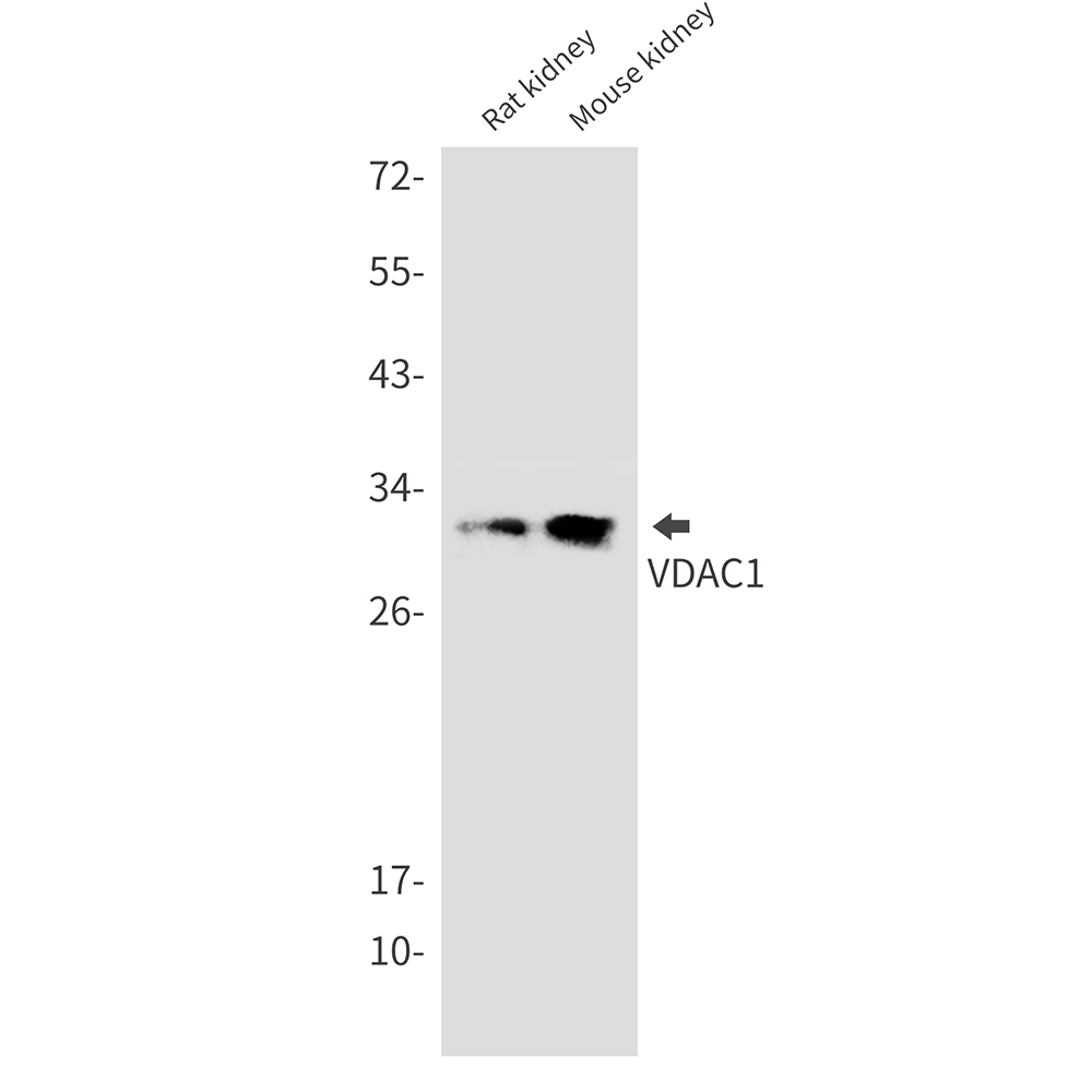 1 - VDAC1/Porin Rabbit mAb AP76240