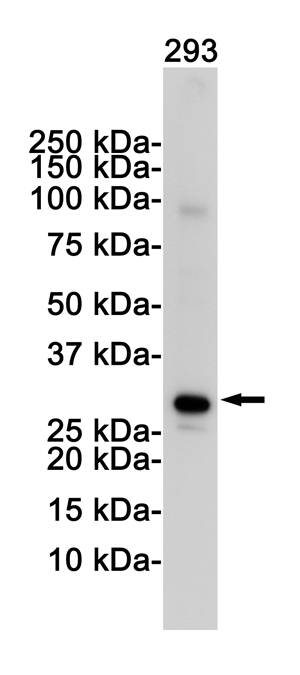 2 - VDAC1/Porin Rabbit mAb AP76240