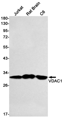 8 - VDAC1/Porin Rabbit mAb AP76240