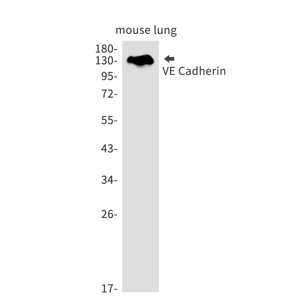 1 - VE Cadherin Rabbit mAb AP76241