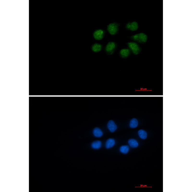 1 - [KD]Phospho-Vimentin (Ser56) Rabbit mAb AP76247