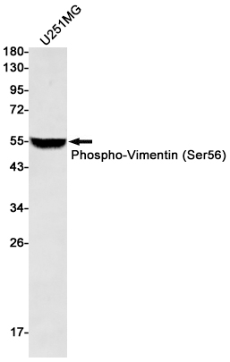 8 - [KD]Phospho-Vimentin (Ser56) Rabbit mAb AP76247