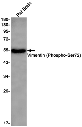 1 - Phospho-Vimentin (Ser72) Rabbit mAb AP76248