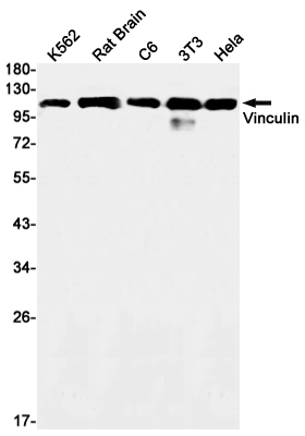 1 - Vinculin Rabbit mAb AP76249