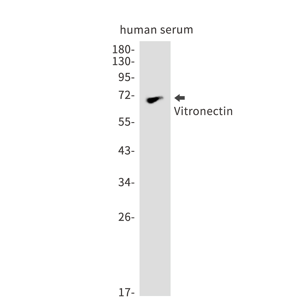 1 - Vitronectin Rabbit mAb AP76251