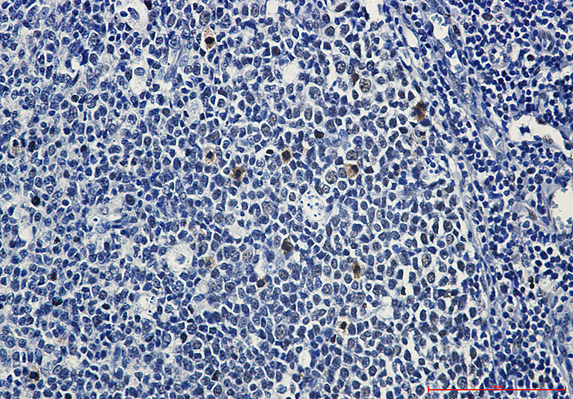 2 - Phospho-c Myb (Ser11) Rabbit mAb AP76252