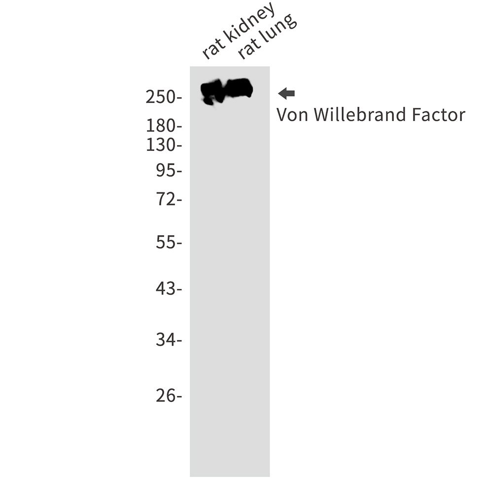 1 - Von Willebrand Factor Rabbit mAb AP76253