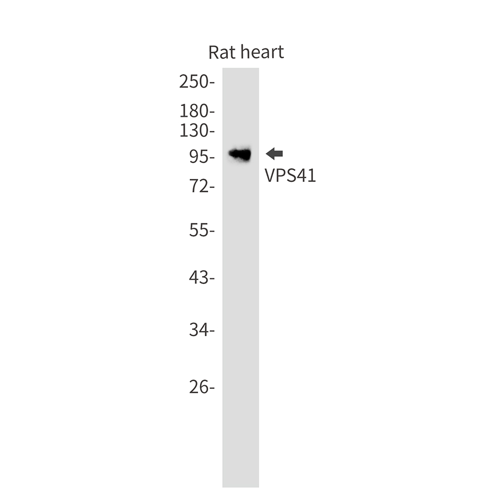 1 - VPS41 Rabbit mAb AP76254
