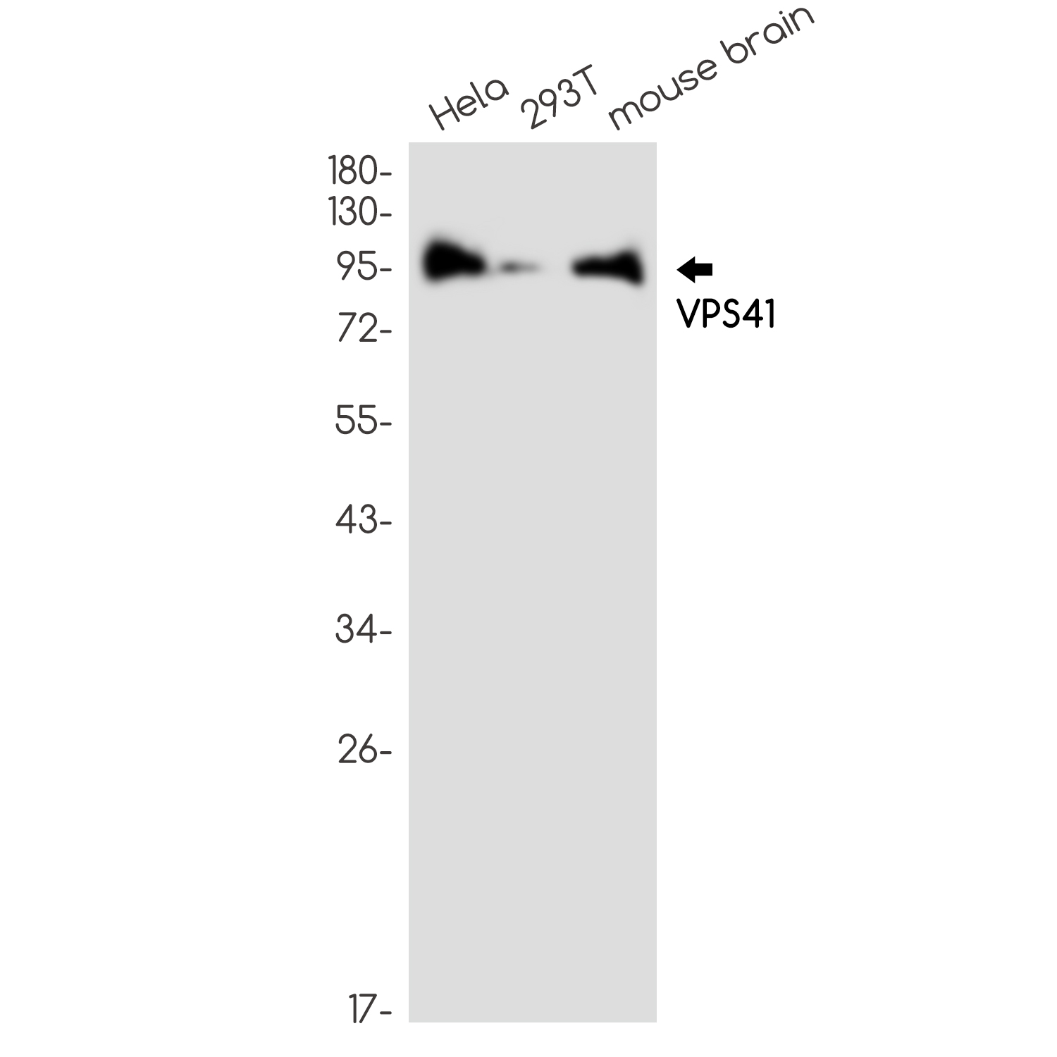 0 - VPS41 Rabbit mAb AP76254