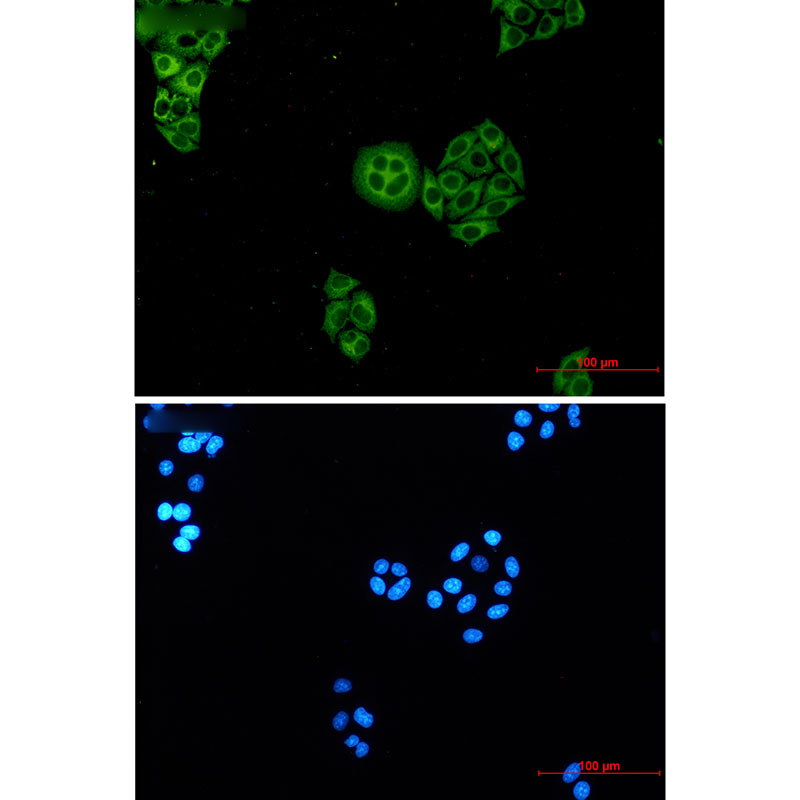 3 - WDR1 Rabbit mAb AP76257