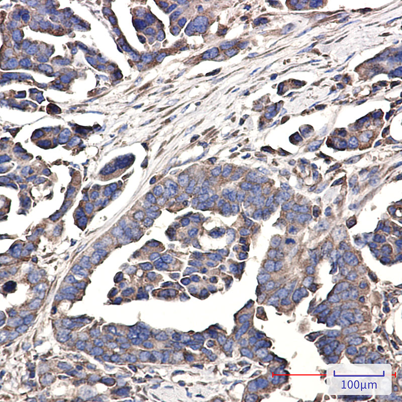 2 - WDR1 Rabbit mAb AP76257