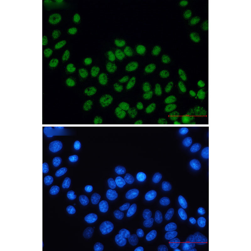2 - XPD Rabbit mAb AP76265