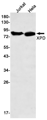 1 - XPD Rabbit mAb AP76265