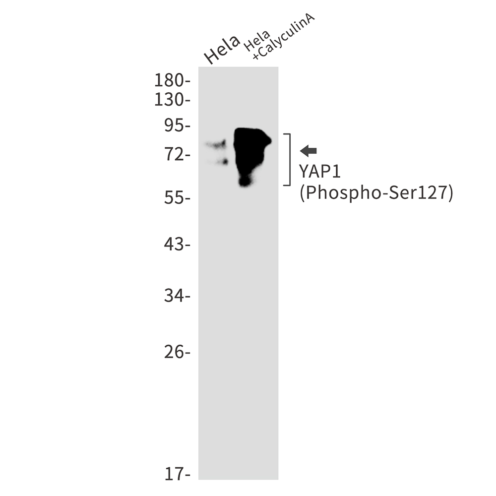 1 - Phospho-YAP1 (Ser127) Rabbit mAb AP76266