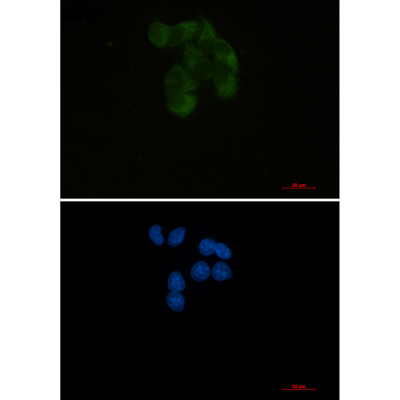 1 - YB1 Rabbit mAb AP76269