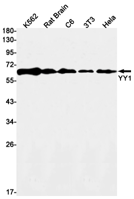 1 - YY1 Rabbit mAb AP76272