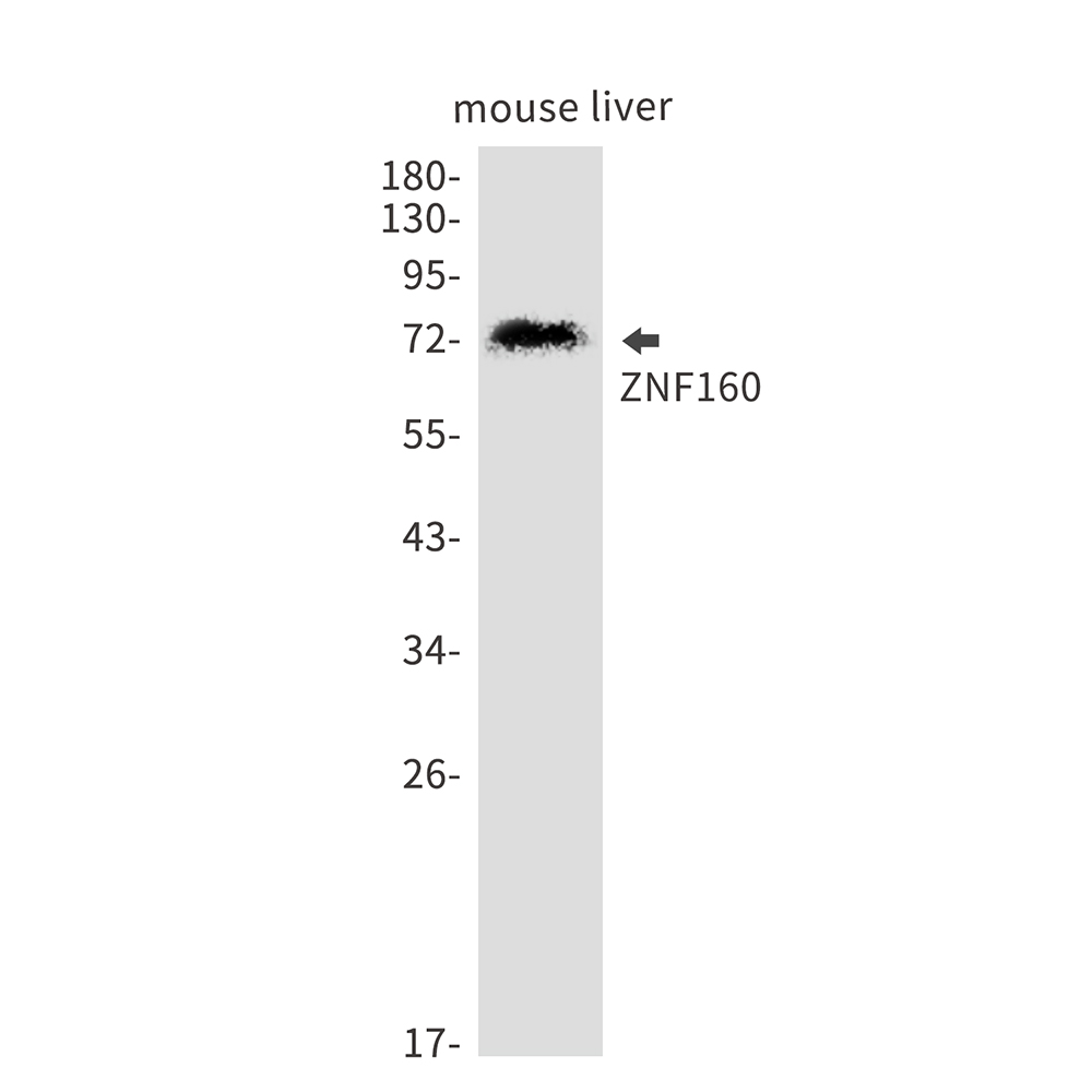 1 - ZNF160 Rabbit mAb AP76275