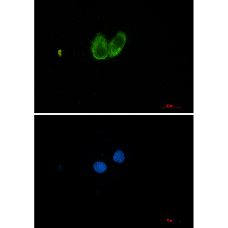 1 - ZYX Rabbit mAb AP76277