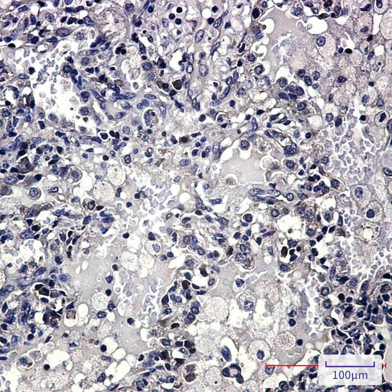 4 - ZYX Rabbit mAb AP76277