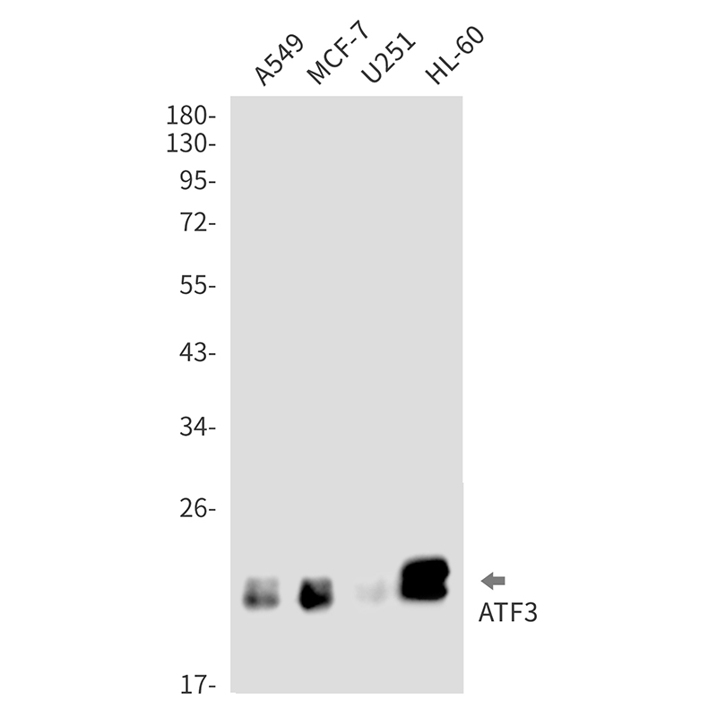 1 - ATF3 Rabbit mAb AP76278