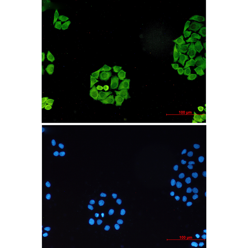 4 - SURF4 Rabbit mAb AP76280