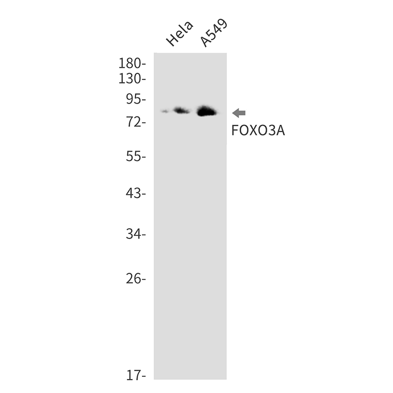 1 - FOXO3A Rabbit mAb AP76282