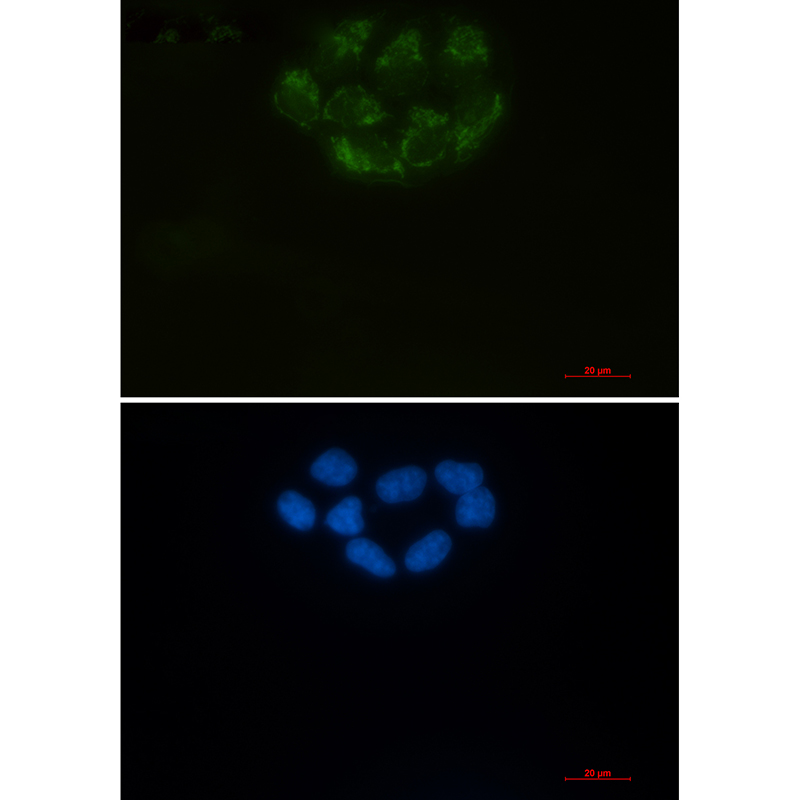 2 - [KD]CD147 Rabbit mAb AP76283