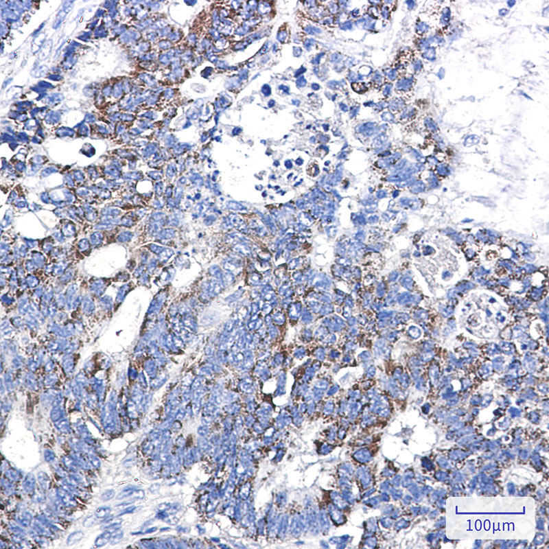 0 - [KD]CD147 Rabbit mAb AP76283