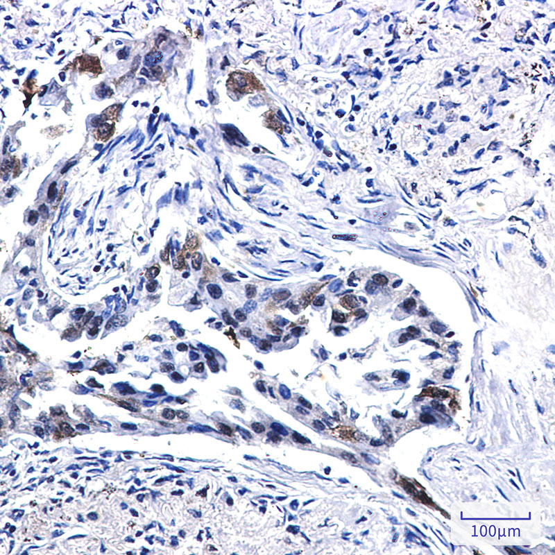8 - Tissue Factor Rabbit mAb AP76284
