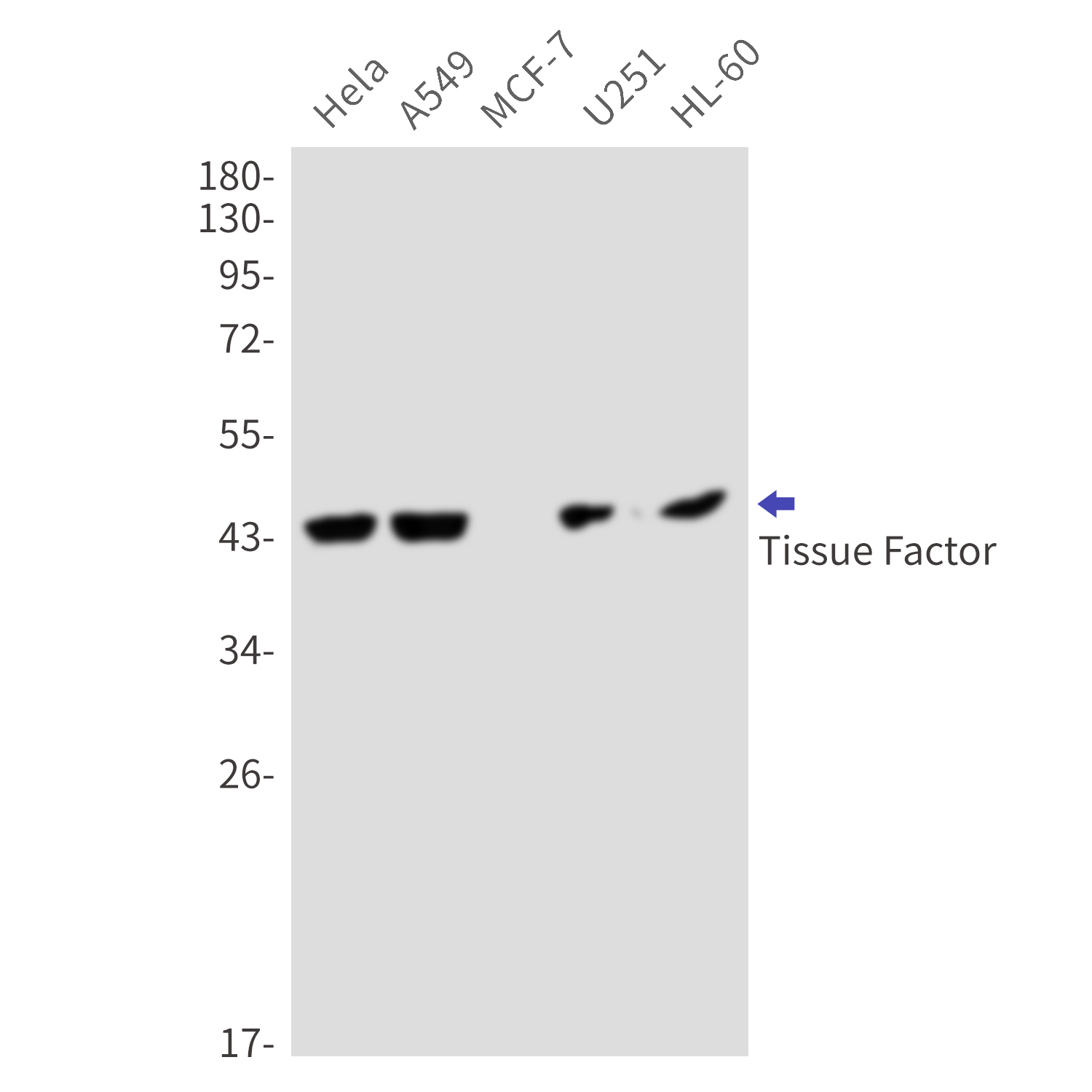 2 - Tissue Factor Rabbit mAb AP76284