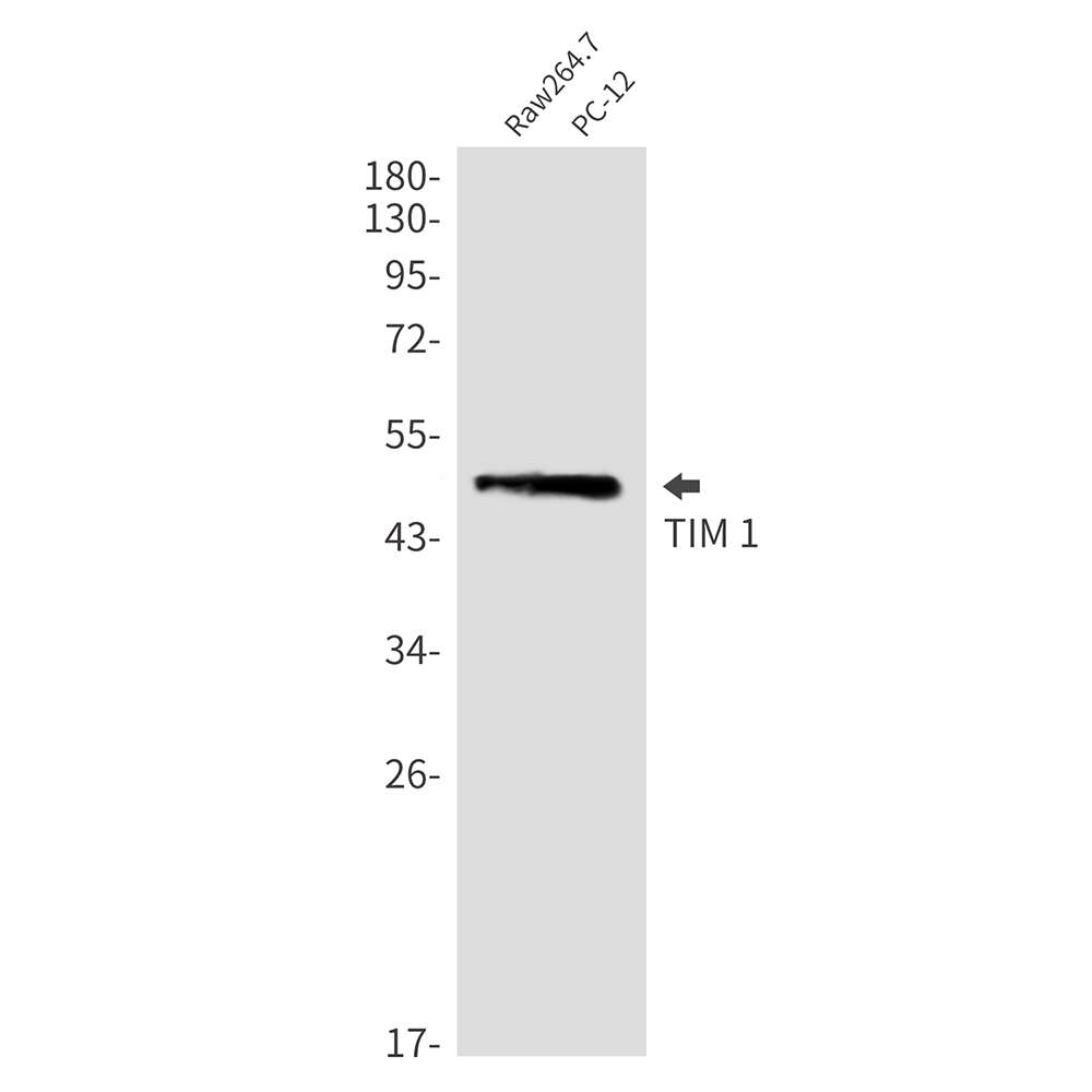 1 - TIM 1 Rabbit mAb AP76285
