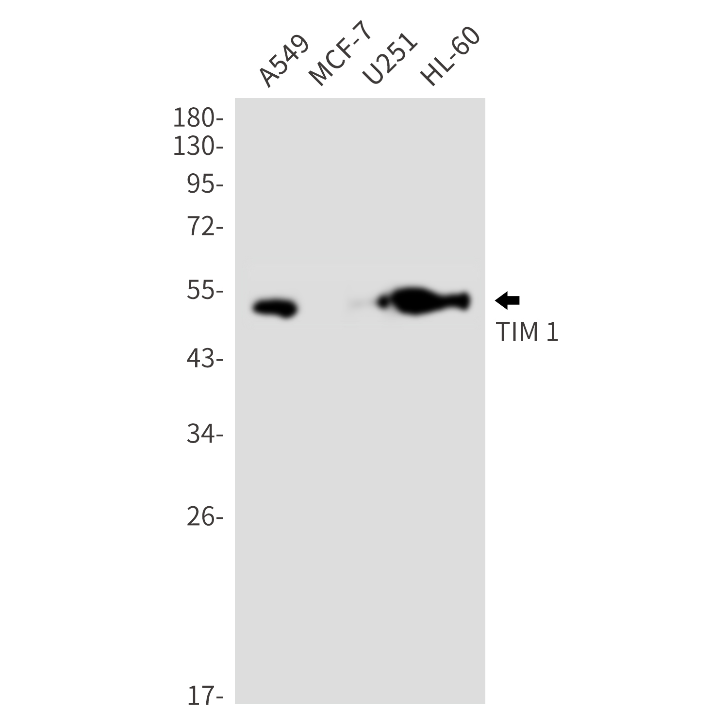 0 - TIM 1 Rabbit mAb AP76285