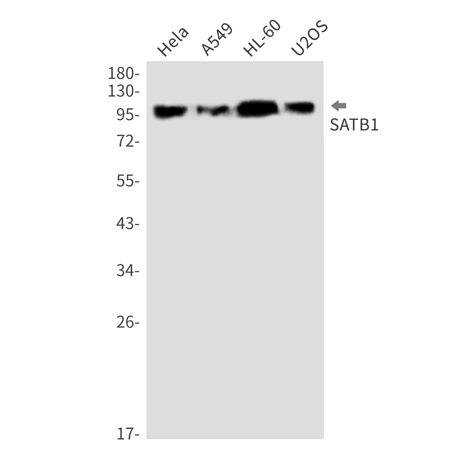 1 - SATB1 Rabbit mAb AP76287