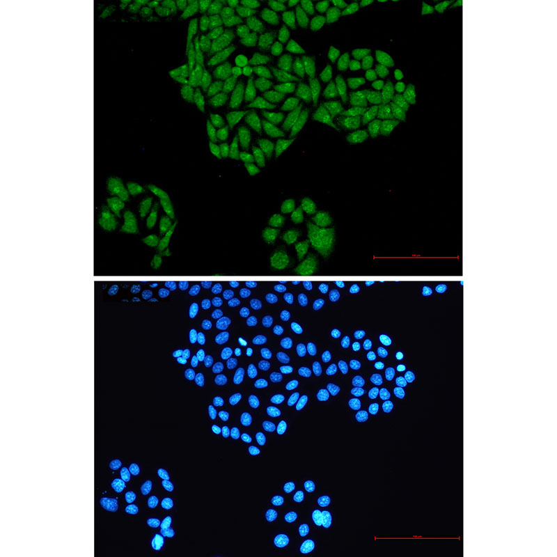 8 - RYK Rabbit mAb AP76288