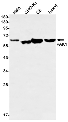 8 - PAK1 Rabbit mAb AP76290