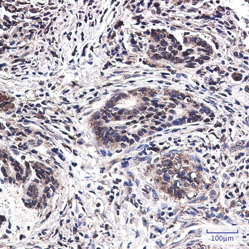 4 - MST1 Rabbit mAb AP76292