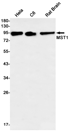 2 - MST1 Rabbit mAb AP76292