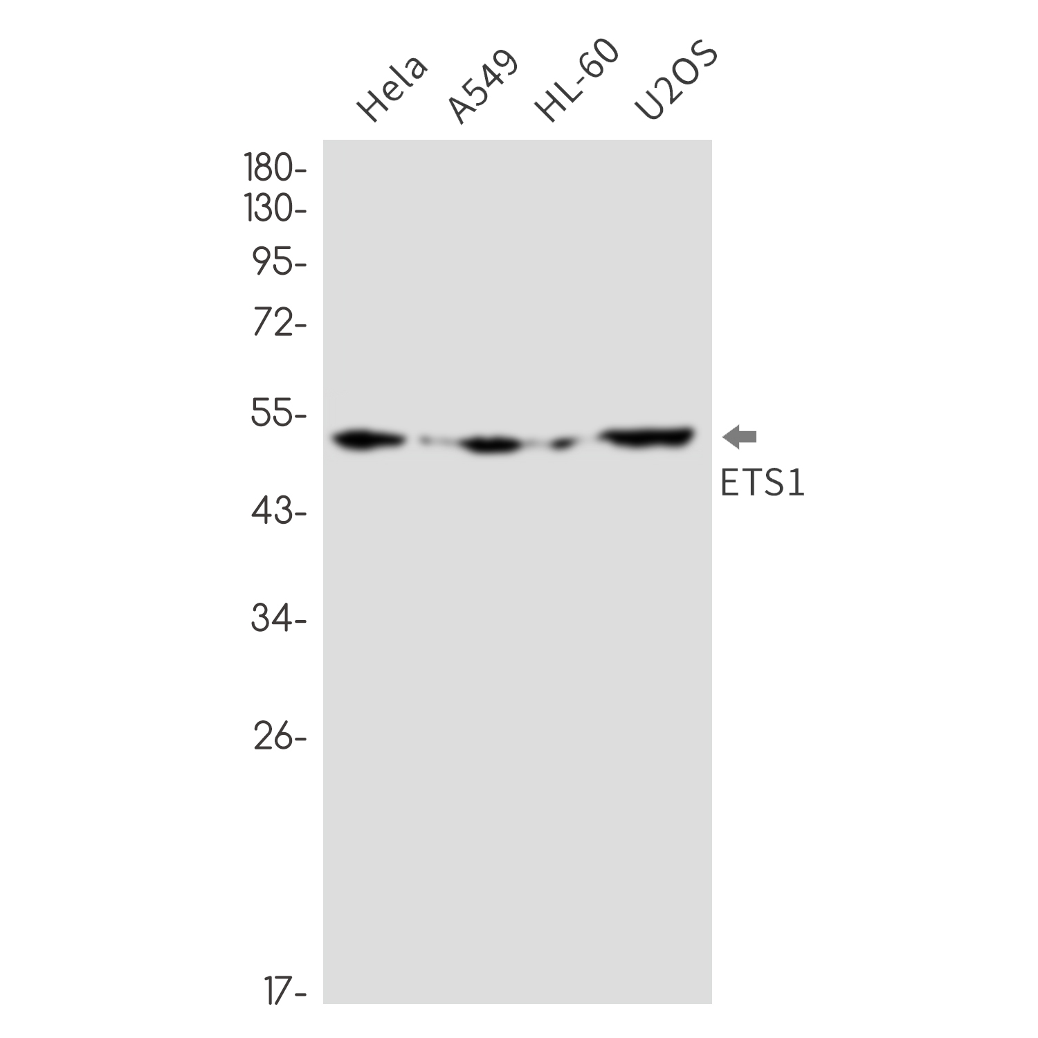 1 - ETS1 Rabbit mAb AP76294