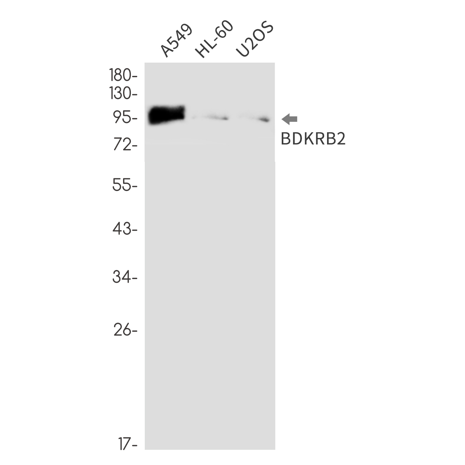 1 - B2R Rabbit mAb AP76295